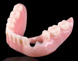 cu sil partial denture