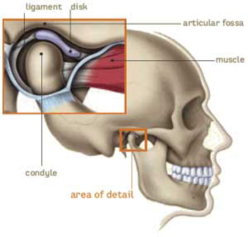 Diagram of the TMJ, or temporomandibular joint